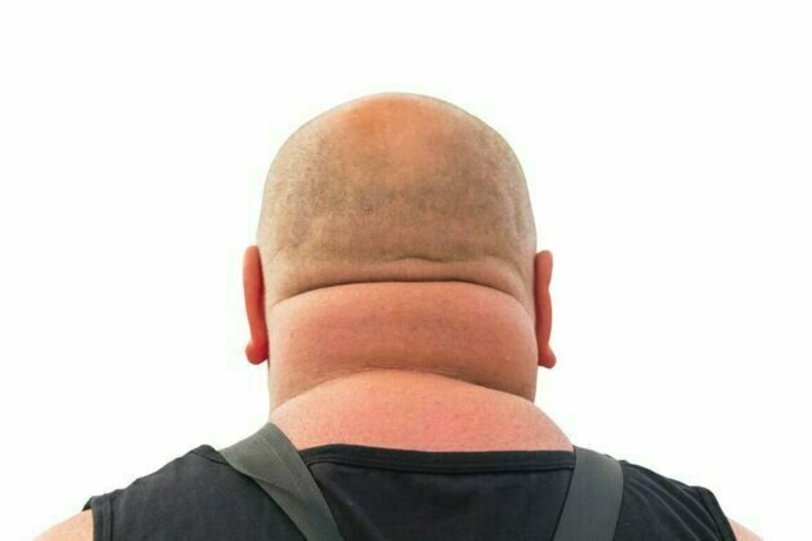 What your neck size reveals about your health