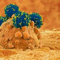CAR-T cell therapy is revolutionising cancer treatment - here's how it works