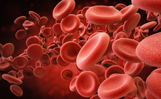 Occident leads CHF 5.1m series-A for Hemotune