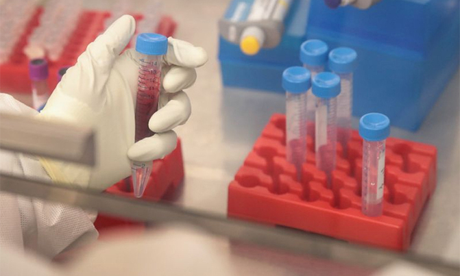 Research institute demystifies strange Luweero disease Research institute demystifies strange Luweero disease