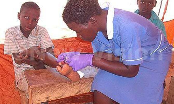 Jiggers linked to spread of HIV Jiggers linked to spread of HIV