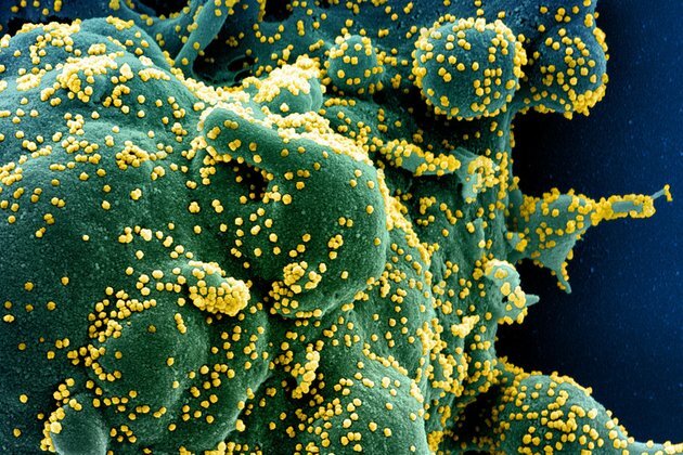 Super mutant Covid strain found in Asia, Middle East