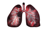  Black lung is debilitating, incurable, and can result in disability and premature death