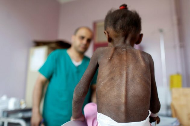 UN: Yemen&#039;s Children Suffer &#039;Devastating Toll&#039; in 5-Year Conflict