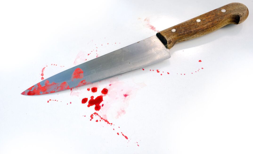 Prepare for The Hunger Games with lab coats