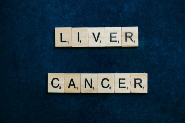 Radio-wave therapy is safe for liver cancer patients