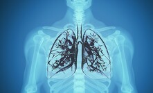 Qld medical provider suspended after substandard black lung testing