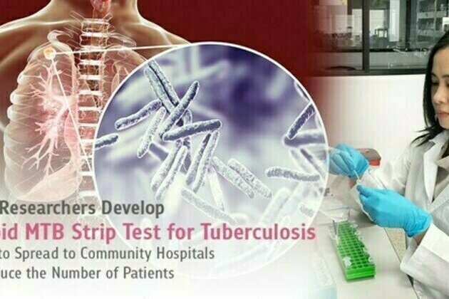 Chula Researchers Develop Rapid MTB Strip Test for Tuberculosis
