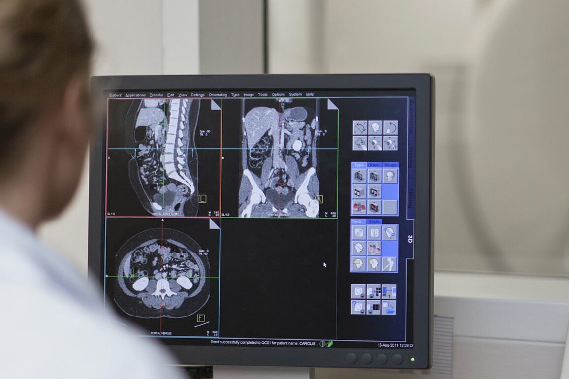 More than 1,000 CT scans investigated after fears raised about radiologist