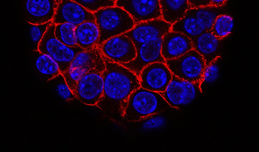 (c) National Cancer Institute 