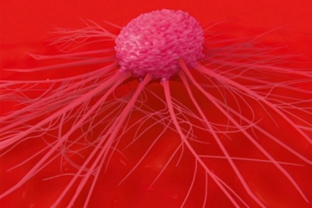 Gene editing tool fights cancer, shows early study