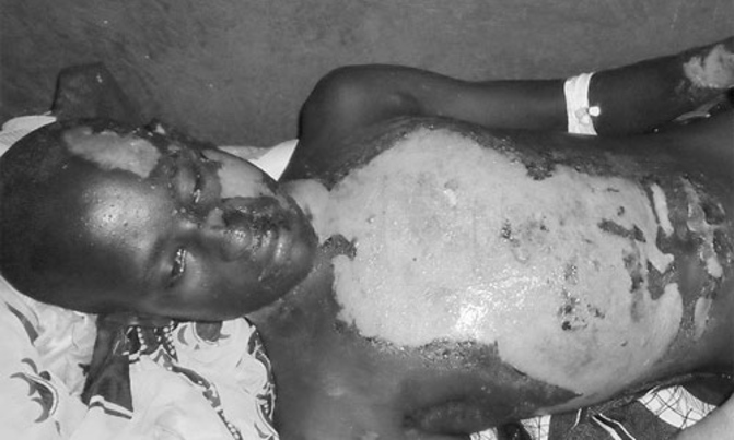 Woman burns husband with porridge over X-mas dress Woman burns husband with porridge over X-mas dress