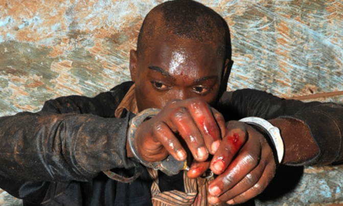 Street kid cuts two policemen during arrest Street kid cuts two policemen during arrest
