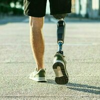 Scientists have been wrong about phantom limbs for decades - new study