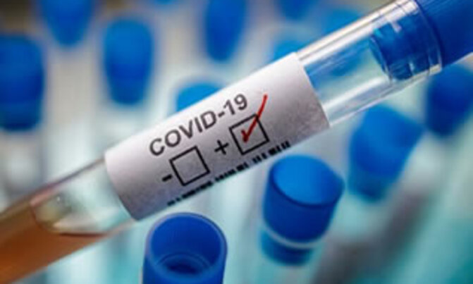 Global coronavirus death toll tops 382,000 Global coronavirus death toll tops 382,000
