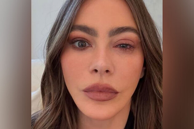 Sofia Vergara misses Emmys due to eye allergy