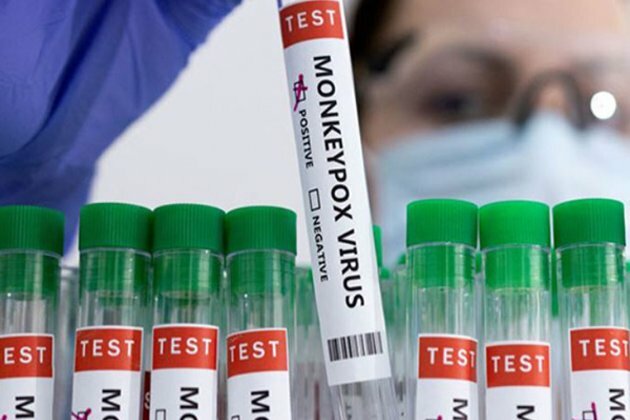 US declares Monkeypox outbreak a Public Health Emergency