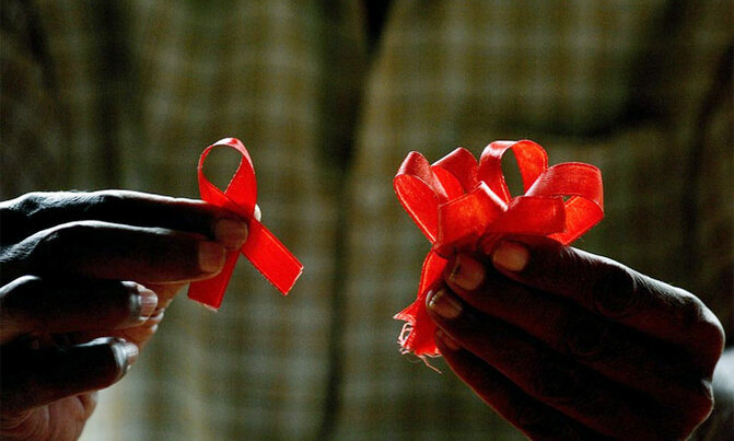 HIV disrupts brainwork HIV disrupts brainwork