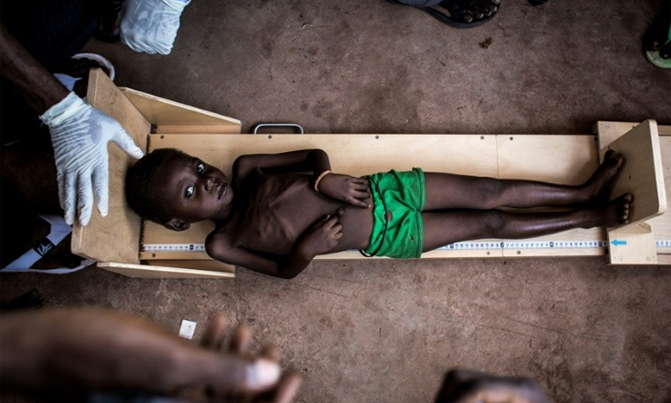 400,000 children in DR Congo could die from hunger, says Unicef 400,000 children in DR Congo could die from hunger, says Unicef