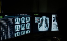 Sequoia, MassMutual back Indian medical imaging player