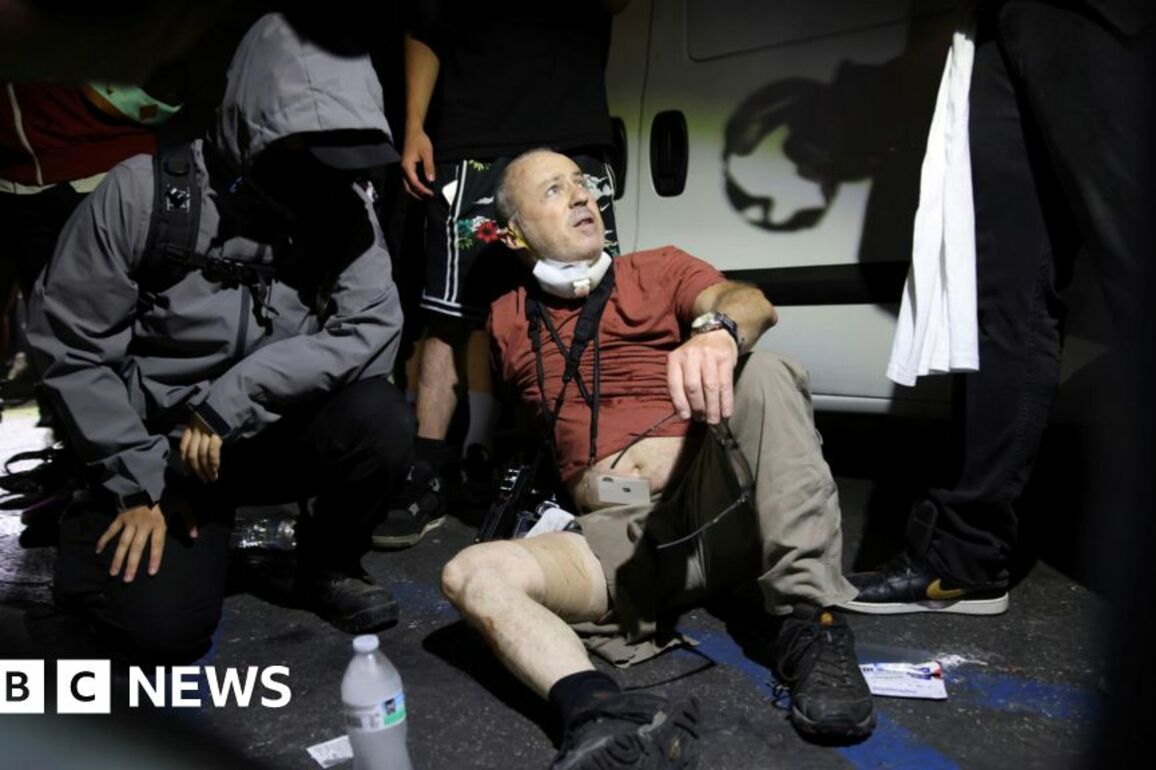 British photographer injured by 'plastic bullet' during LA protests