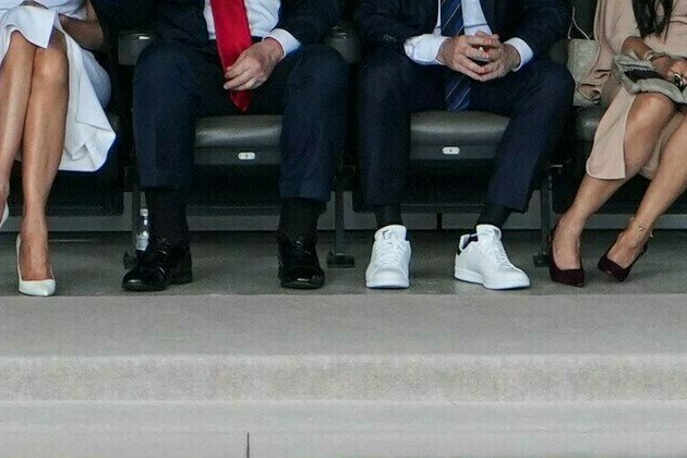 White House explains Trumps swollen ankles and bruised hand
