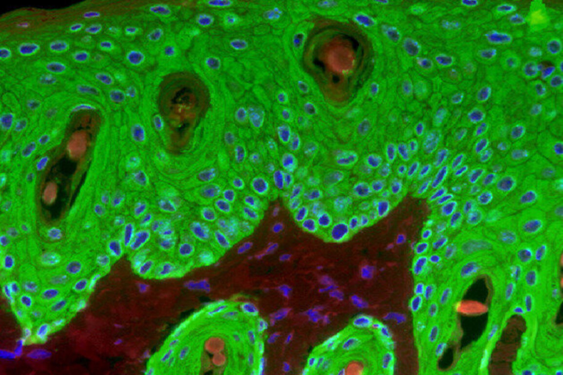Japanese researchers develop implanted 'living skin' that glows to signal health changes