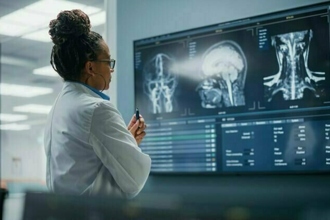 Brains of people with schizophrenia may age faster - how our research adds to the evidence