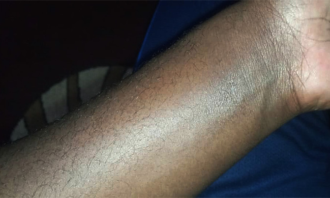 Coronavirus 'survives on skin five times longer than flu' Coronavirus 'survives on skin five times longer than flu'