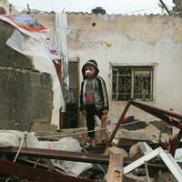 Opinion- Looking at the world, the idea of progress seems hollow