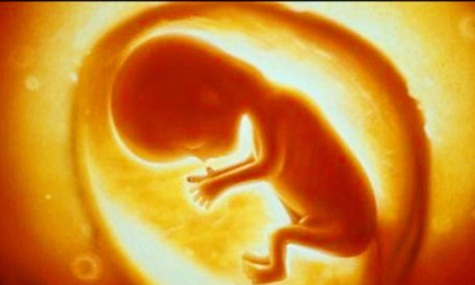 Abortion bans around the world Abortion bans around the world