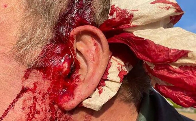 70-year-old farmer assaulted with rock in 'unprovoked' attack