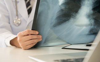 Pulse Insurance extends Reframe Cancer offering