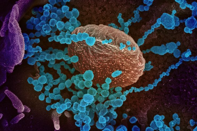 Coronavirus: a new type of vaccine using RNA could help defeat COVID-19