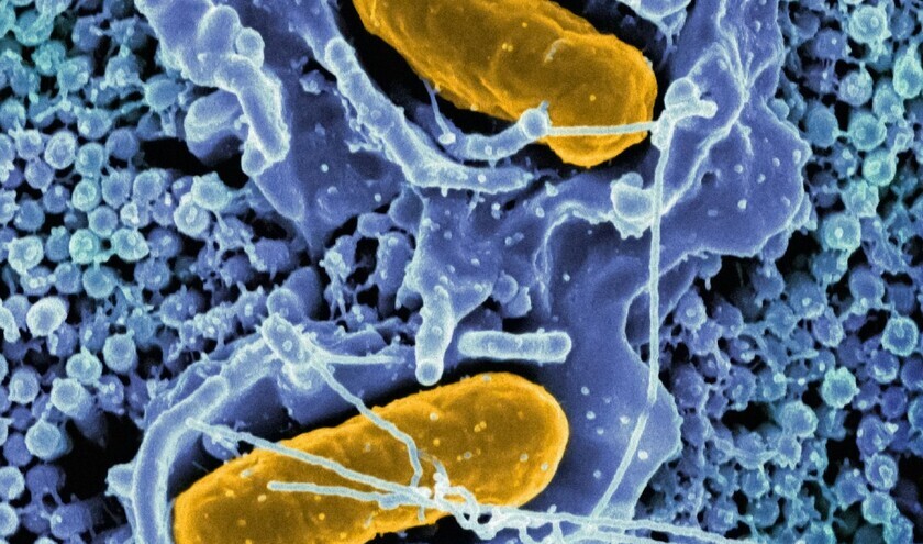 (C) National Institute of Allergy and Infectious Diseases/Unsplash 