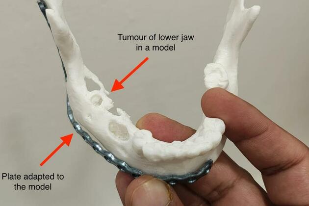 Oral cancer care- Understanding treatment options and the importance of rehabilitation