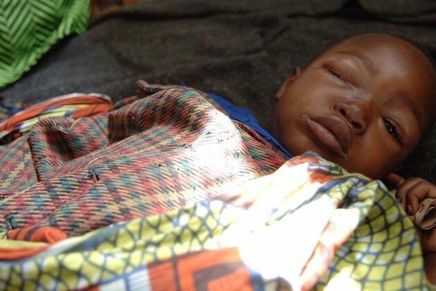 Monkeypox outbreak can still be contained, insists UN health agency