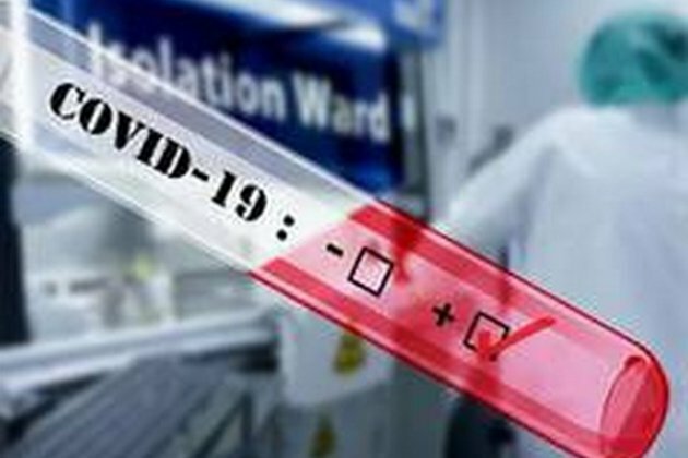 Israel's daily new COVID-19 death cases hit record high