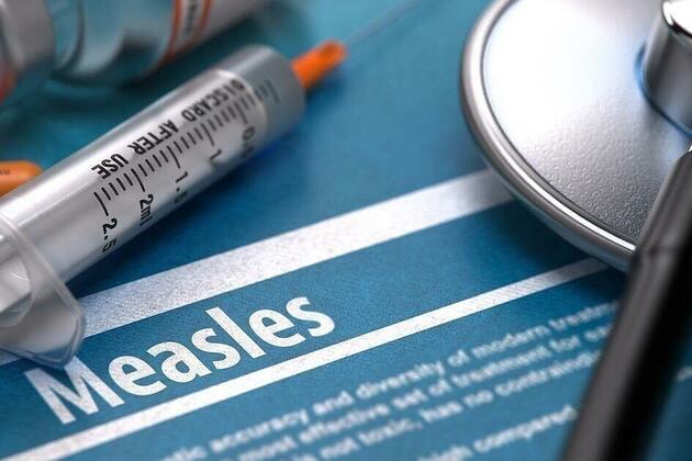 Lewis and Clark Public Health monitoring US measles outbreak