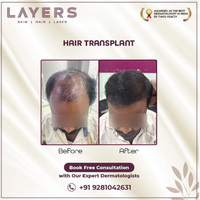 Rapid Nationwide Expansion: Layers Skin and Hair Clinics Continues to Sculpt Beauty Inside and Out