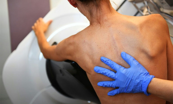 'Artificial mole' could warn of cancer: study 'Artificial mole' could warn of cancer: study