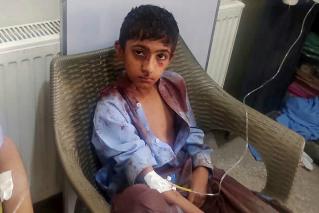 At Least 47 Dead in Bombing of Pakistan Religious Rally