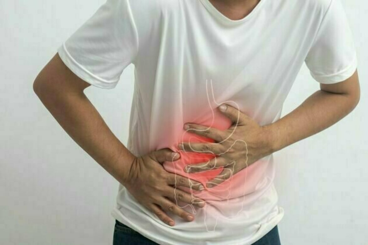 Diverticular disease: the surprisingly common gut condition you've probably never heard of