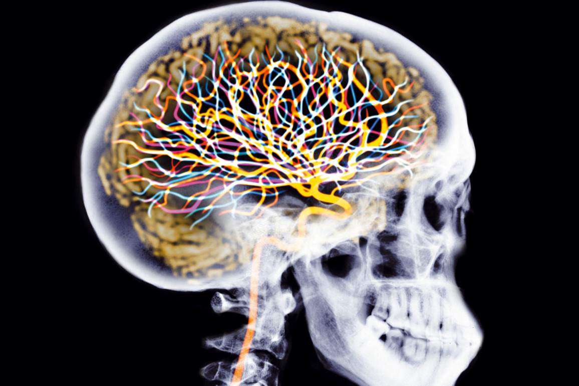 Run It and brain injuries- What you need to know