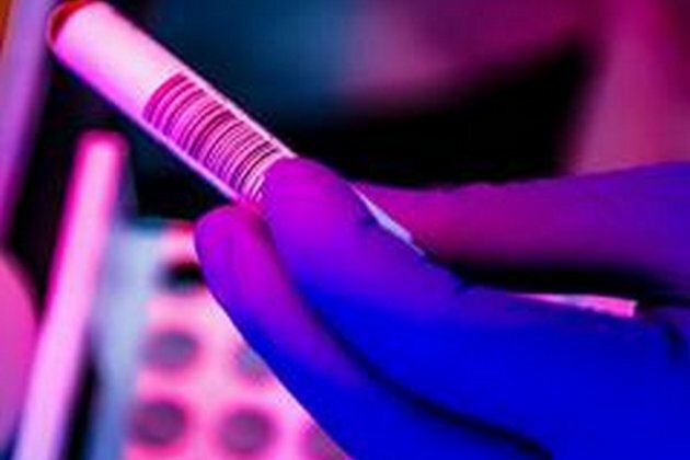 Moderna to request Emergency Use Authorization from FDA