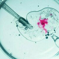 Weight loss support before IVF could boost pregnancy chances - and reduce the need for treatment