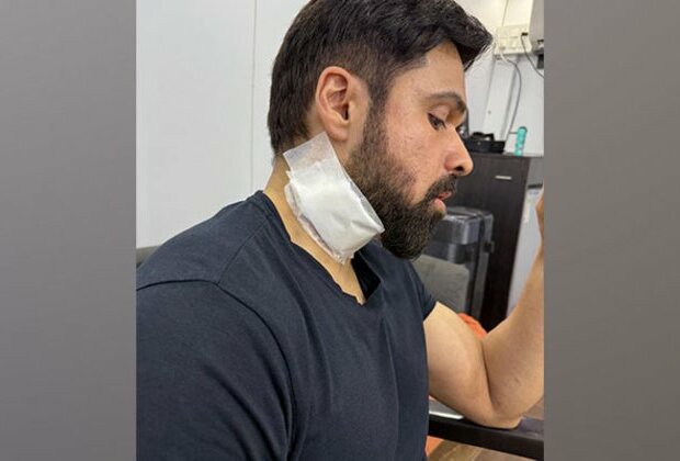 Emraan Hashmi gets injured during 'Goodachari 2' in Hyderabad