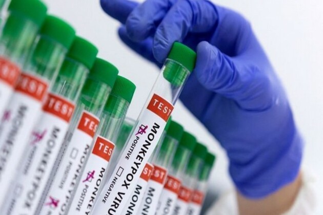 Ghana reported 45 confirmed cases of monkeypox in past month