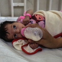MIDEAST-GAZA CITY-HUNGER-MALNUTRITION