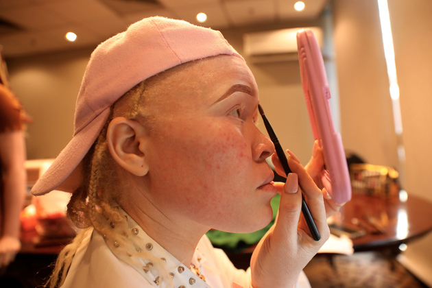 ZIMBABWE-HARARE-ALBINISM-PAGEANT